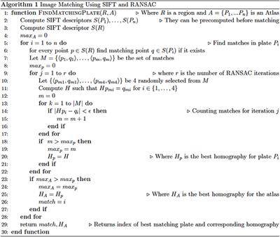 Computer Vision Evidence Supporting Craniometric Alignment of Rat Brain Atlases to Streamline Expert-Guided, First-Order Migration of Hypothalamic Spatial Datasets Related to Behavioral Control